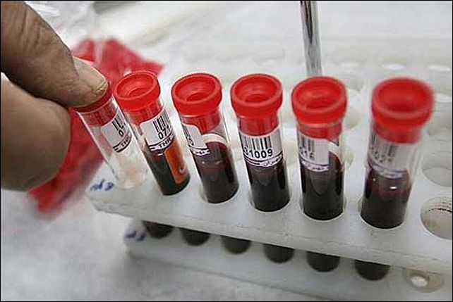 Число инфекционных больных снизилось в регионе на 13%