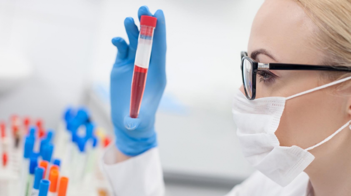 Жи­те­ли Ни­же­го­род­ской об­ла­сти мо­гут узнать свой ВИЧ-ста­тус