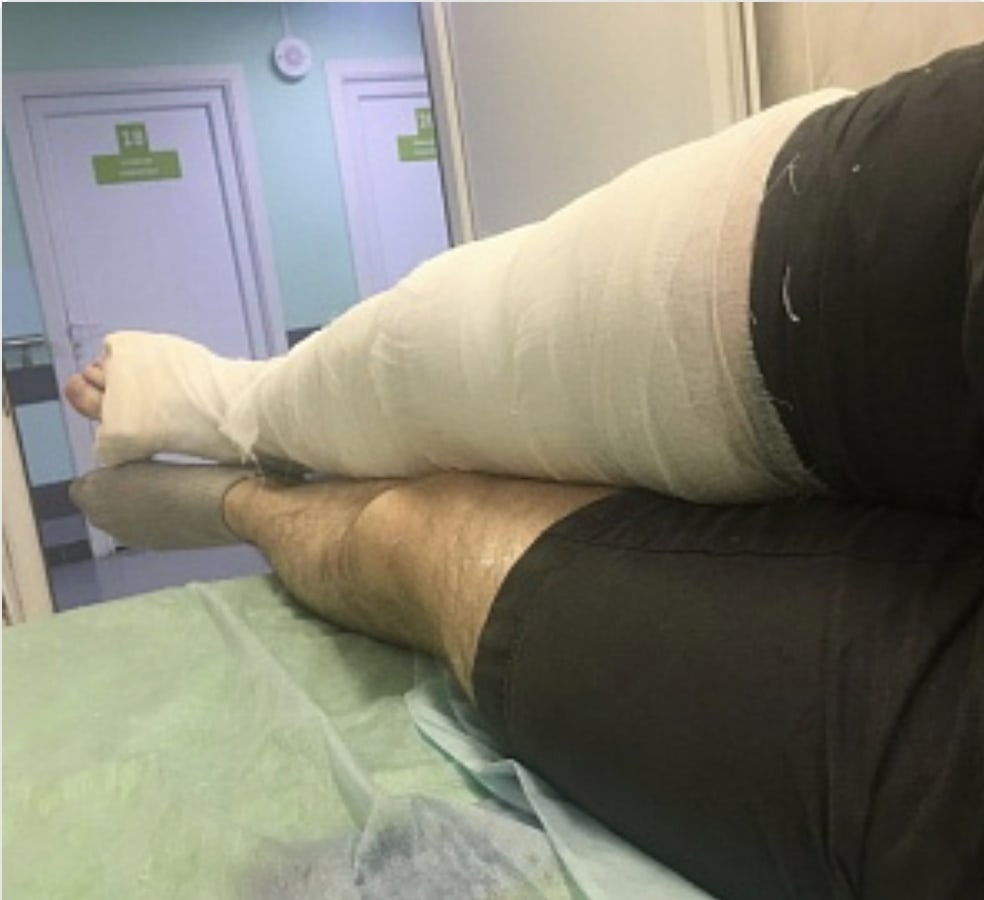 Сотрудник борского производства получил тяжелую травму