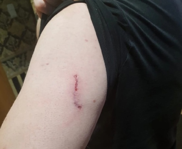 Нападение бездомной собаки на человека расследуют на Бору