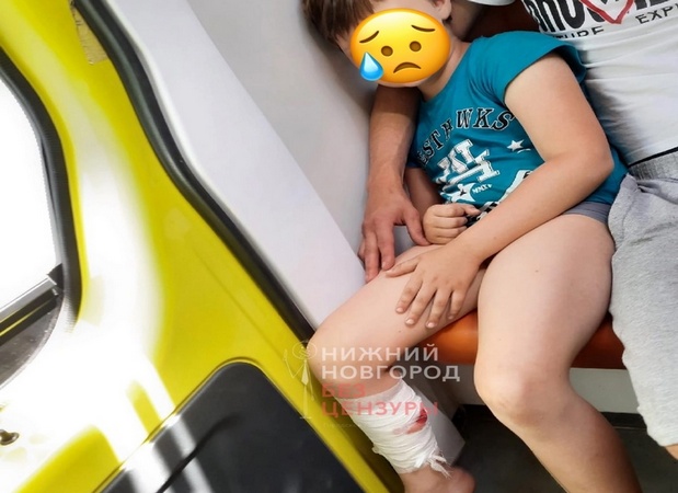 Собака искусала ребёнка в Октябрьском