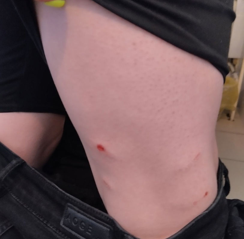 В Октябрьском собака искусала девочку