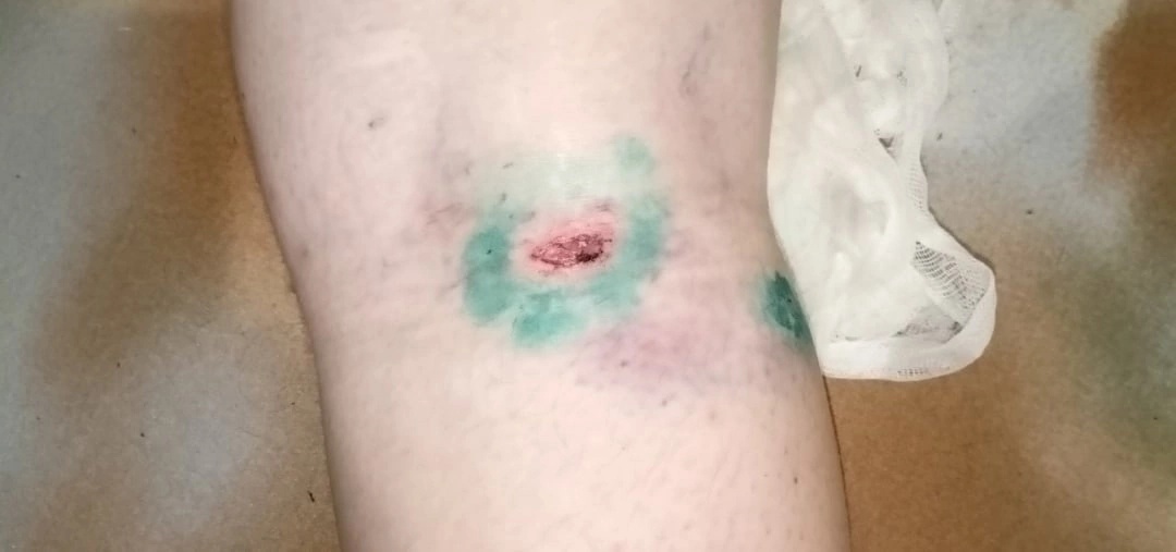 Количество искусанных агрессивной собакой исчисляется десятками