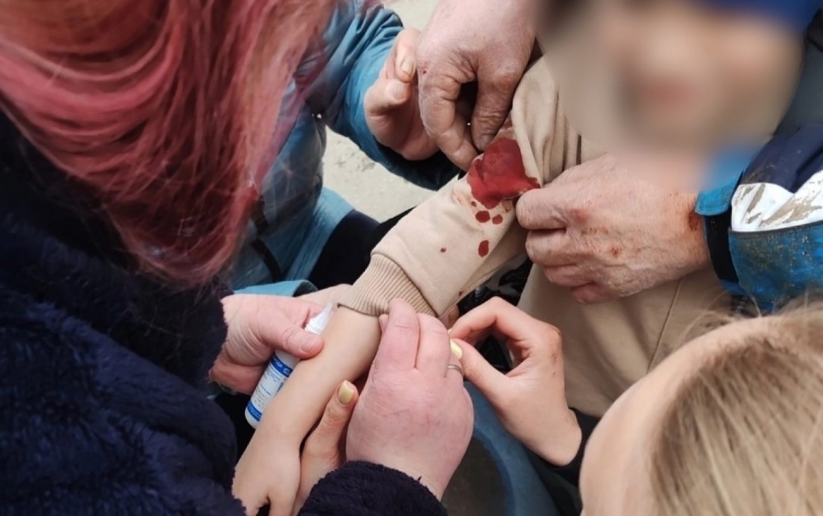 В Борском районе возбуждено уголовное дело по случаю нападения домашней собаки на маленького ребёнка