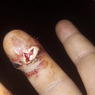 Количество искусанных агрессивной собакой исчисляется десятками 2