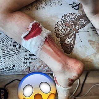 Собака искусала ребёнка в Октябрьском 2