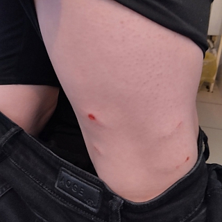 Количество искусанных агрессивной собакой исчисляется десятками 1