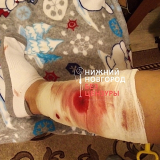 Собака искусала ребёнка в Октябрьском 1