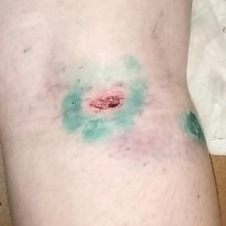 Количество искусанных агрессивной собакой исчисляется десятками 4