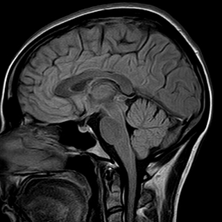 МРТ-исследования в медицинском центре "Гарантия" в городе Бор 1